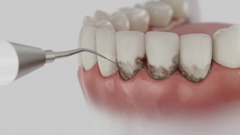 Reliable Dental Implants contractor in Kensington, MD by Smile Center Dentistry